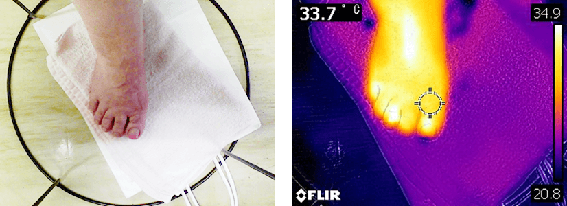 足の冷えのサーモカメラ